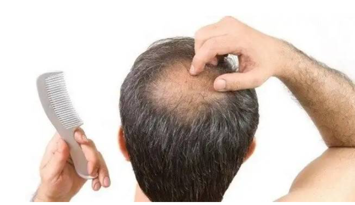 Revifol Hair Loss 