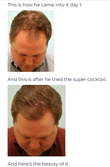 Revifol Hair Loss 