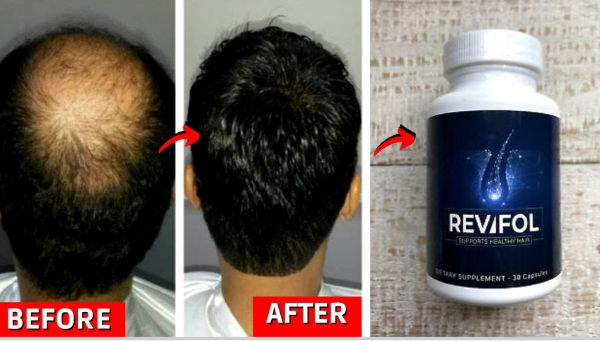 Revifol Hair Loss 