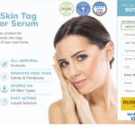 Treme Skin Tag Remover