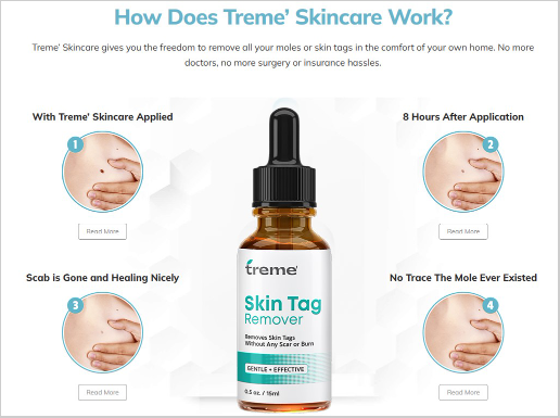 Treme Skin Tag Remover